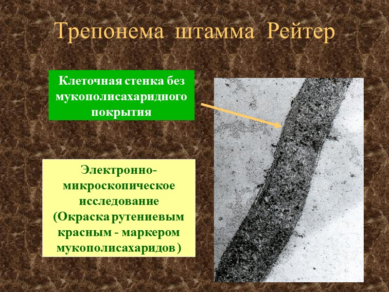 Трепонема  штамма  Рейтер Электронно-микроскопическое исследование (Окраска рутениевым красным - маркером мукополисахаридов )